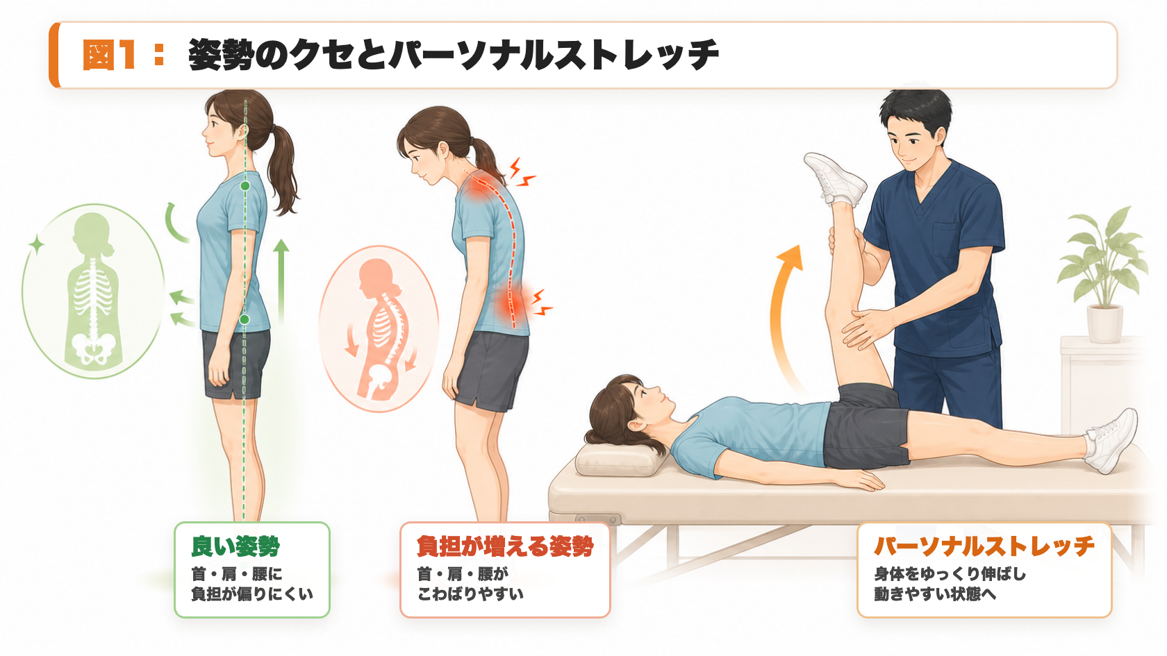 図1：姿勢のクセとパーソナルストレッチ。良い姿勢、負担が増える姿勢、施術者によるストレッチを比較した説明図。