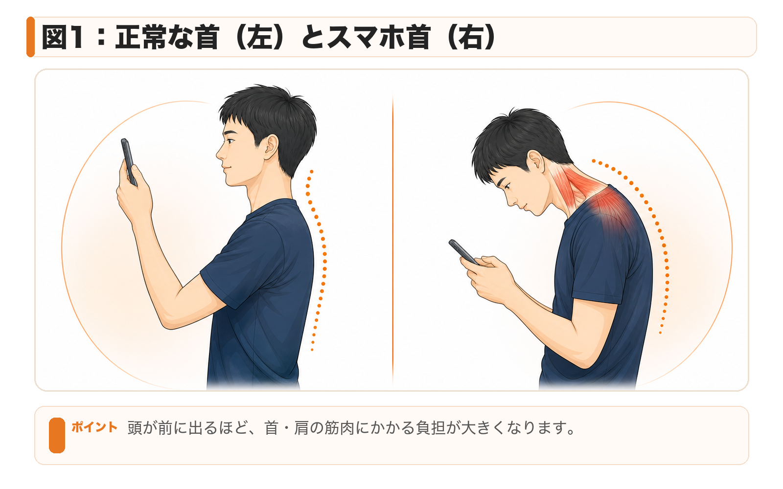 図1：正常な首（左）とスマホ首（右）。頭が前に出るほど、首・肩の筋肉にかかる負担が大きくなります。