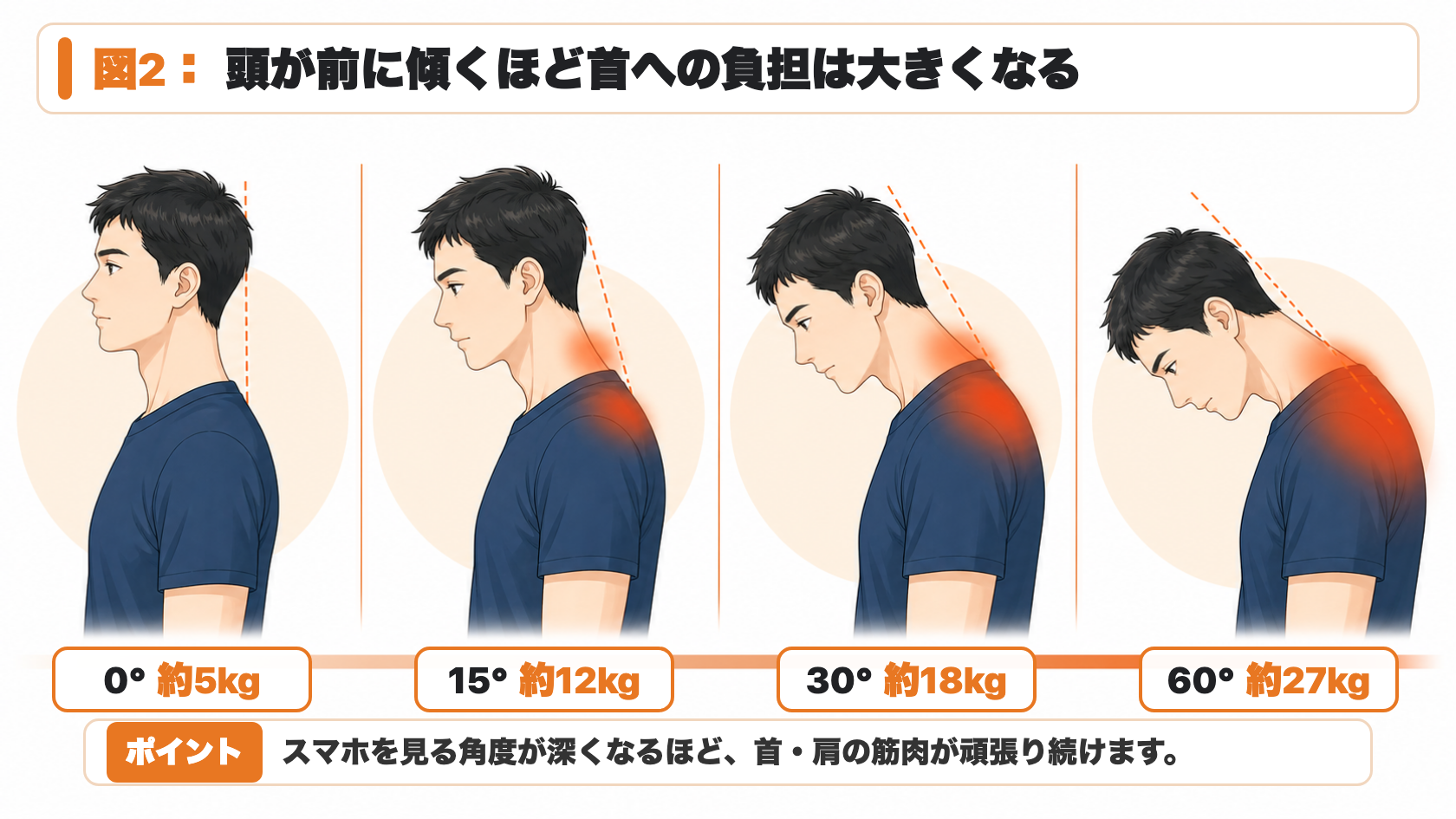 図2：頭が前に傾くほど首への負担が大きくなる説明図。0度は約5kg、15度は約12kg、30度は約18kg、60度は約27kg。