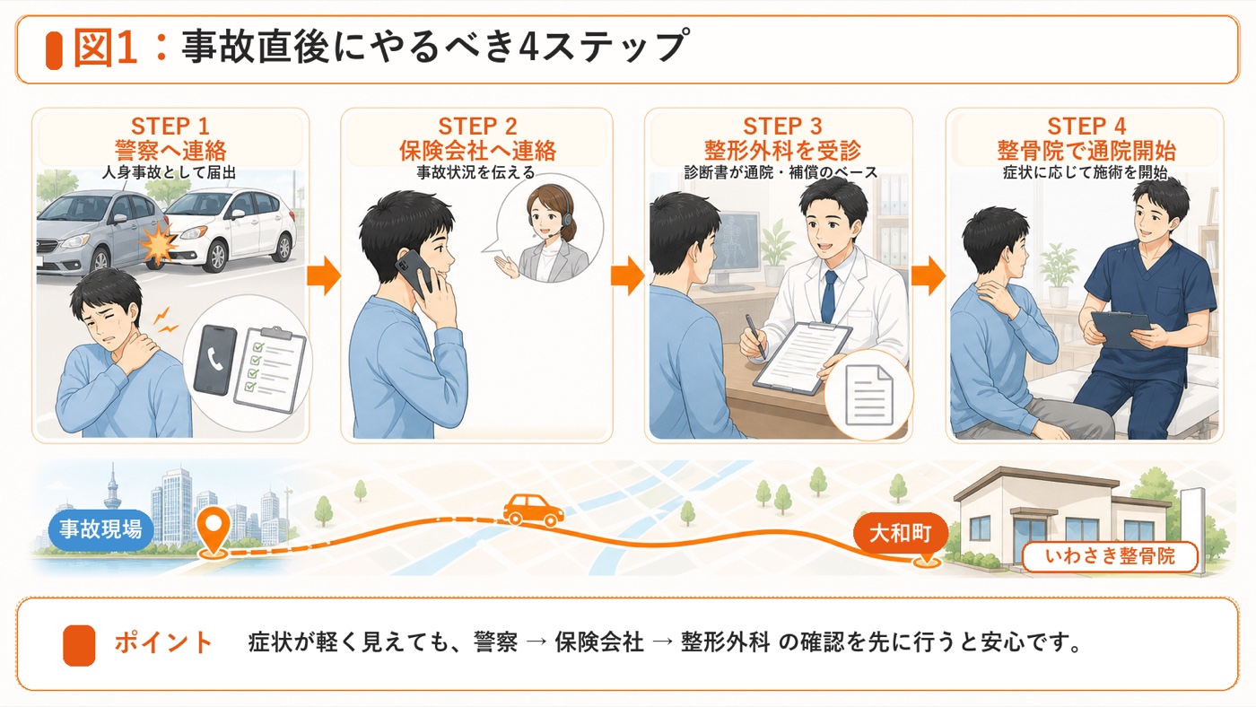 図1：事故直後にやるべき4ステップ。警察への連絡、保険会社への連絡、整形外科受診、整骨院での通院開始までを患者さま向けに示した説明図。